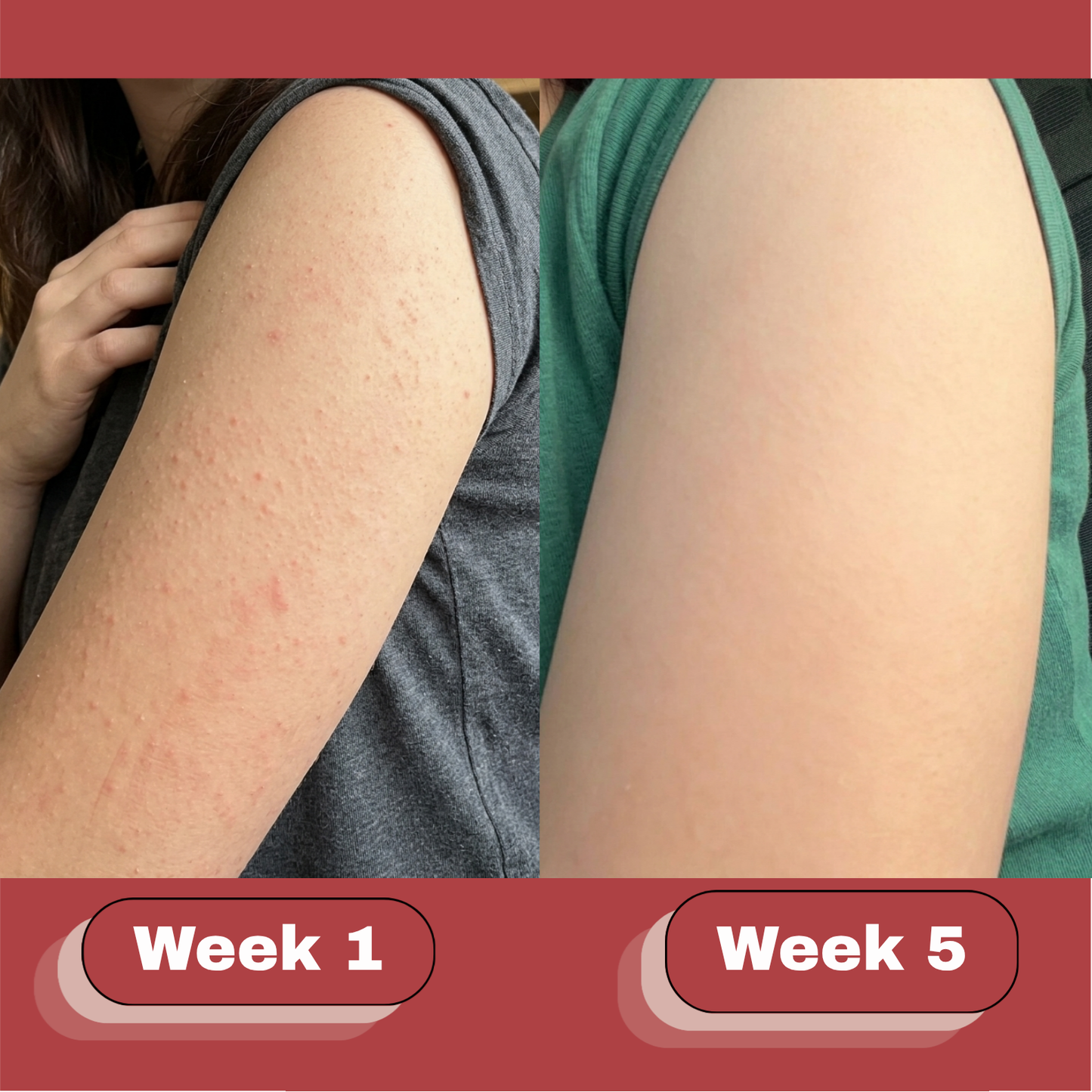 OceAura Strawberry Skin Cream
