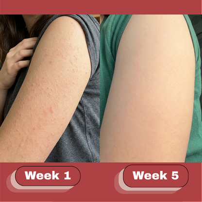 OceAura Strawberry Skin Cream
